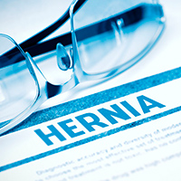 Hernia-Medicine-Concept-63610549_200